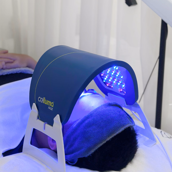 Điều trị mụn chuyên sâu